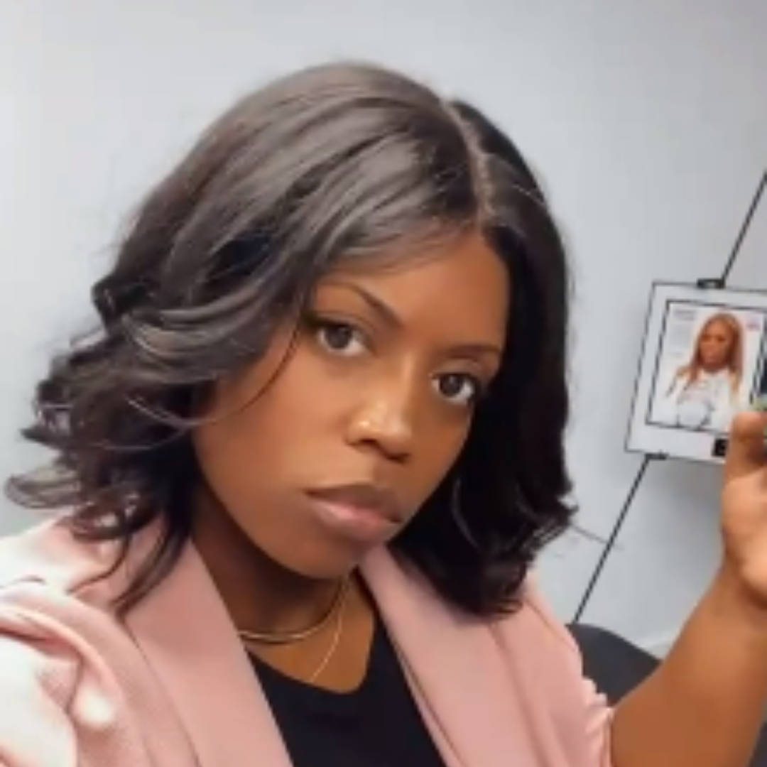 Customized Alopecia Hair Unit Topper for Women Suffering from Alopecia