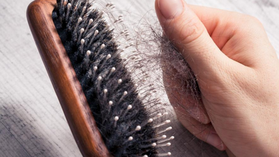 Other Reason for Hair loss (Alopecia)