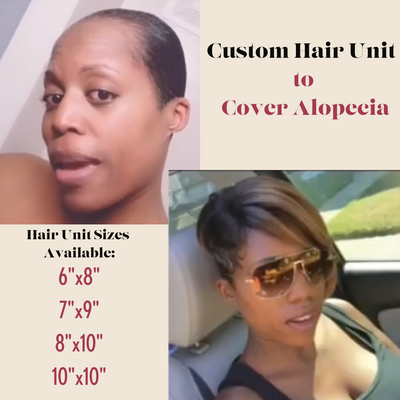 Customized Alopecia Hair Unit Topper for Women Suffering from Alopecia
